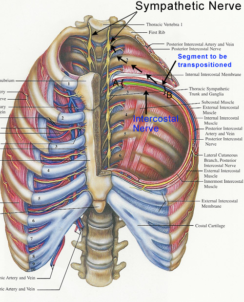 Sympathetic Nerve Diagram