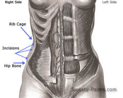 Lumbar Sympathectomy