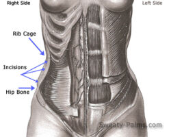 Lumbar Sympathectomy