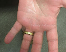 Sweaty Palms